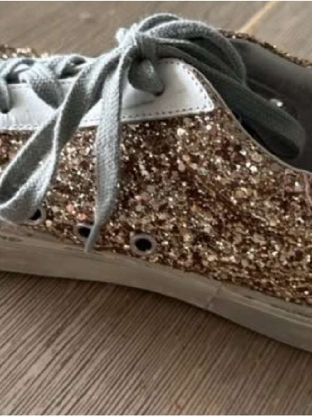 Golden Goose High Star Shoes - Picture 3 of 6